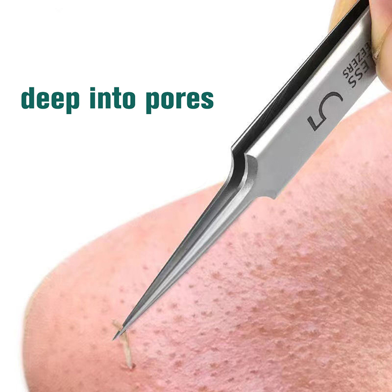 ZaskórnikiX - Precyzyjne narzędzie do oczyszczania skóry twa…